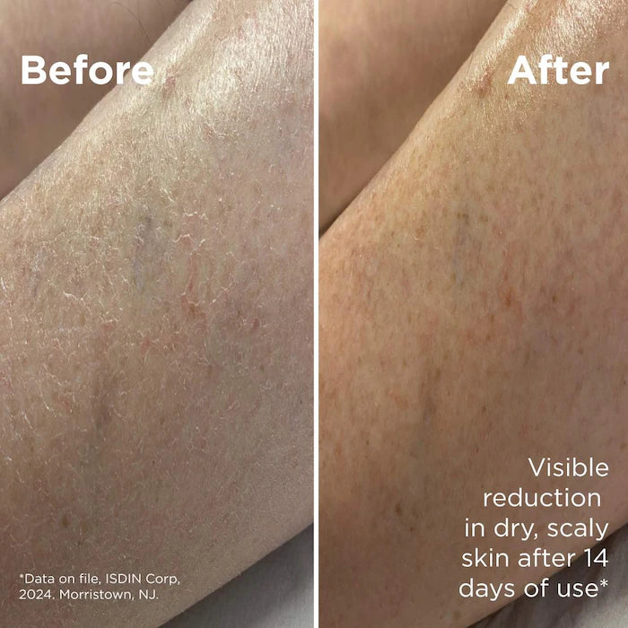 ISDIN Uradin Lotion 10 Hydrating Body Lotion for Dry Skin