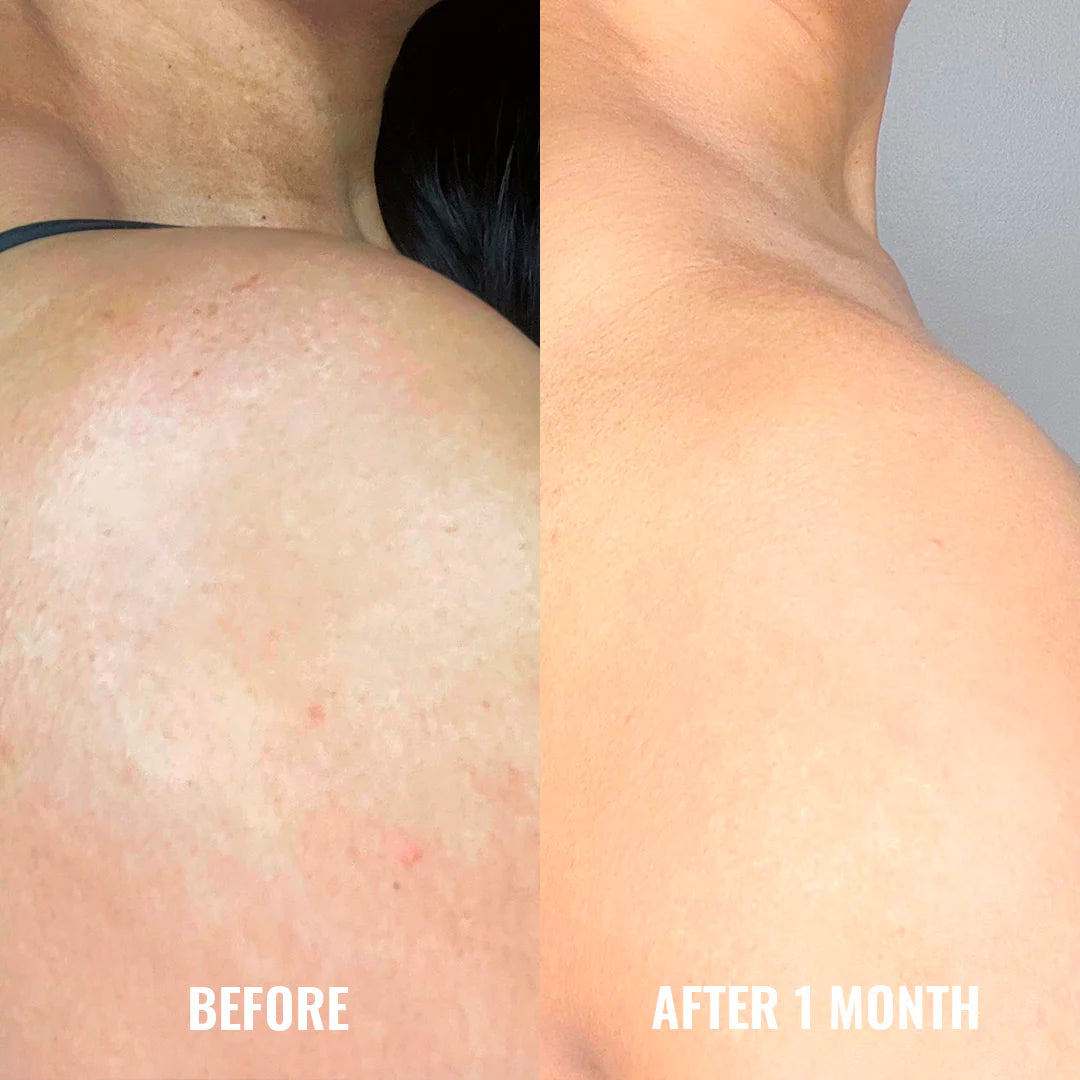 Good Molecules Discoloration Correcting Body Treatment