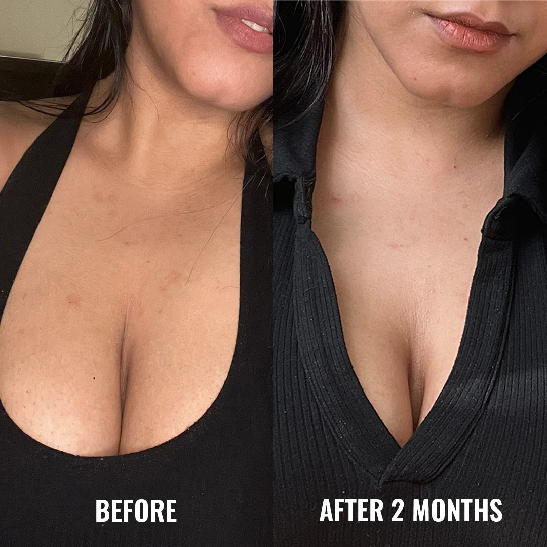 Good Molecules Discoloration Correcting Body Treatment