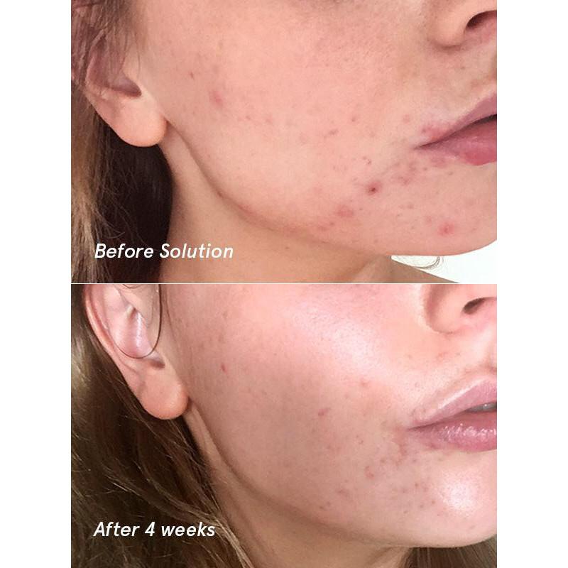 Glossier Solution Tonic