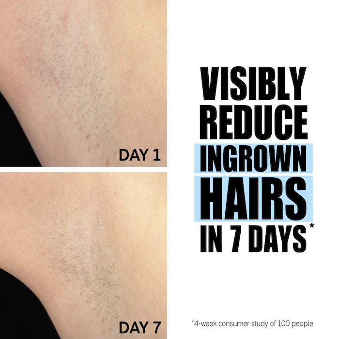 The INKEY List Glycolic Acid Exfoliating Body Stick