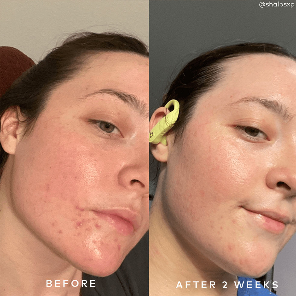 Good Molecules Clarify & Cleanse Bar