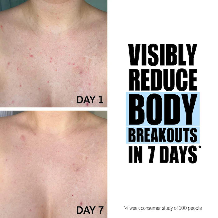 The INKEY List Glycolic Acid Exfoliating Body Stick