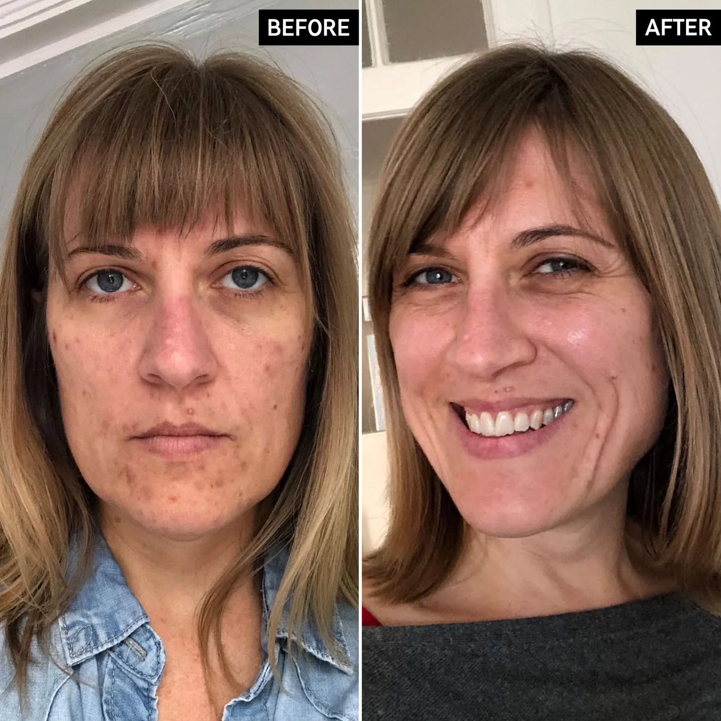 The Inkey List Retinol Anti Aging Serum