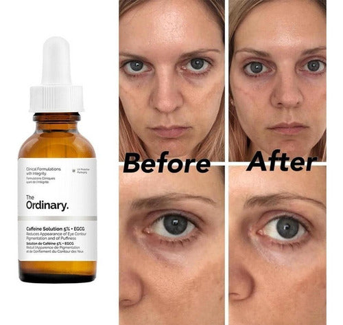 The Ordinary Caffeine Solution + EGCG