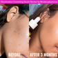 Good molecules Discoloration Correcting Serum