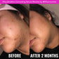 Good molecules Discoloration Correcting Serum