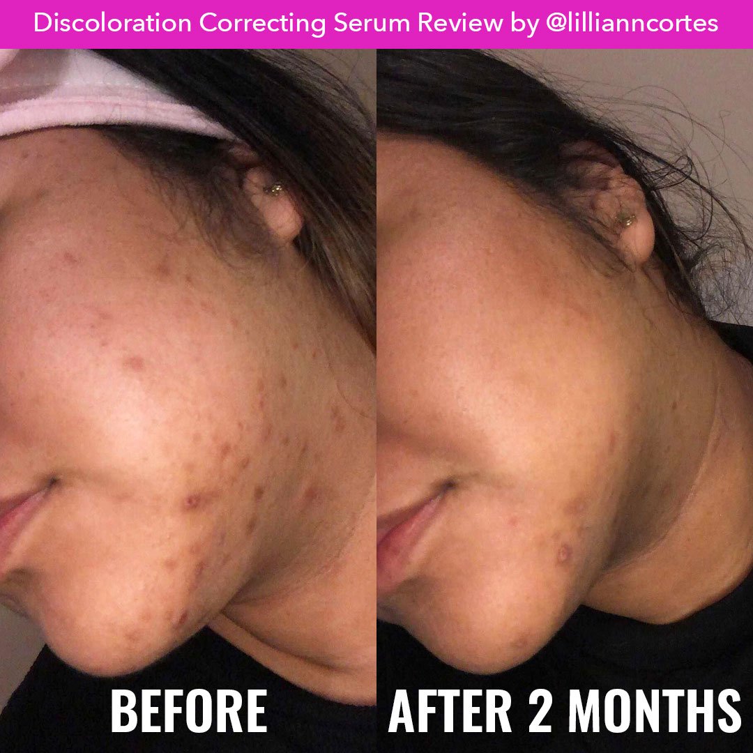 Good molecules Discoloration Correcting Serum